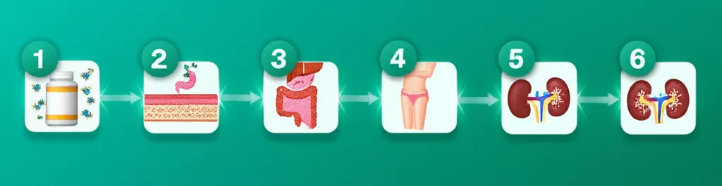 Medical diagram illustrating high calcium levels in blood due to hypercalcemia